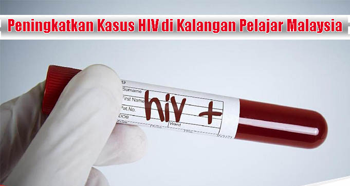 Peningkatkan Kasus HIV di Kalangan Pelajar Malaysia